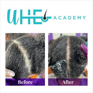 Luxe Scalp Ozone Treatment Online Training